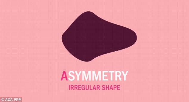 비대칭(Asymmetry)