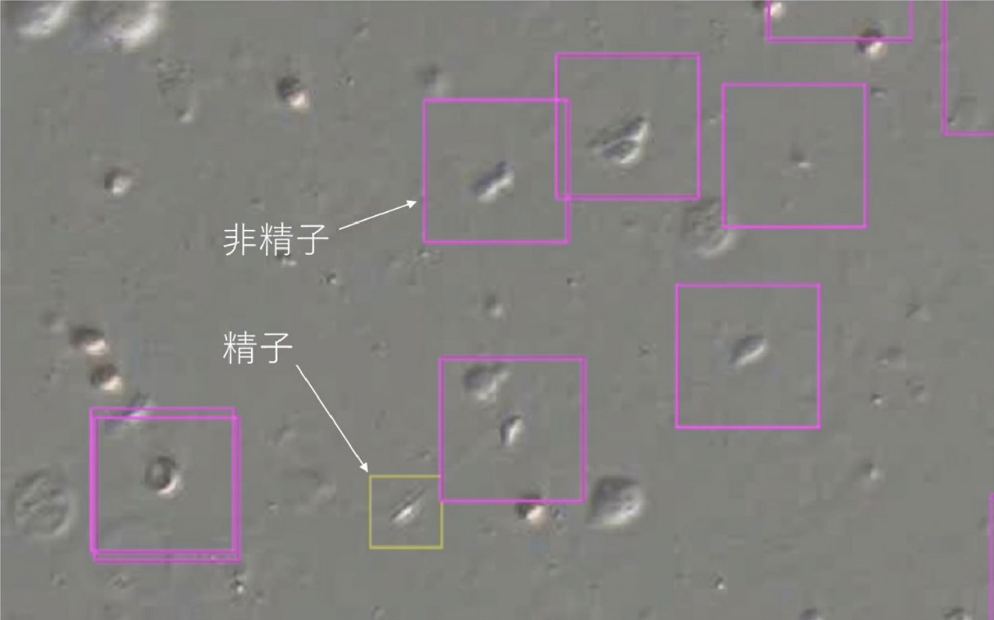 남성 불임치료 돕는 인공지능(AI)…日 연구팀, ‘정자 선별 시스템’ 개발