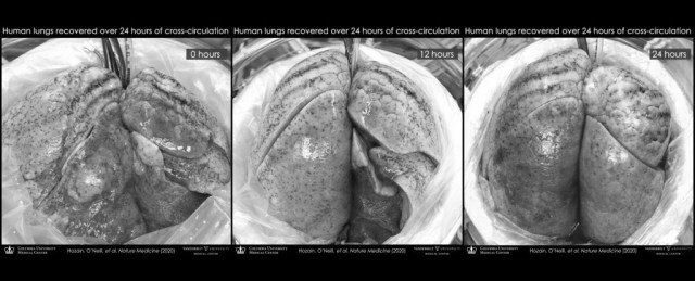 손상된 폐를 돼지 몸에 연결하고 24시간이 지나자 외형이 크게 변했다.(사진=아메드 호자인, 존 오닐/컬럼비아대)