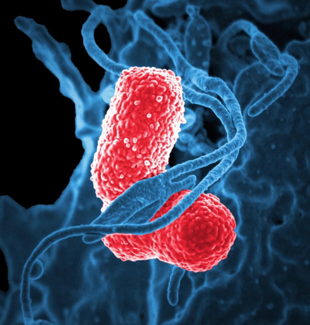 (다제 내성 폐렴간균의 모습. 출처: David Dorward; Ph.D.; National Institute of Allergy and Infectious Diseases)