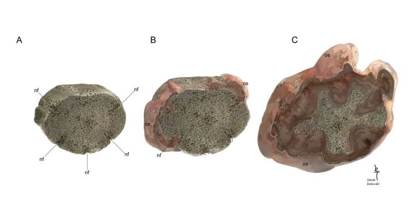 메토포사우루스의 척추뼈에 침투하는 골육종의 모습. 사진=Jakub Zalewski