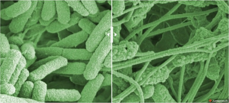 녹농균의 전자 현미경 사진(왼쪽)과 락토바실루스 드레싱 적용 후 사진(오른쪽). 사진=Empa