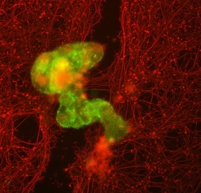 다세포 로봇의 집합체인 슈퍼봇(녹색)이 뉴런(빨간색)의 성장을 자극하는 모습. 사진=미국 터프츠대