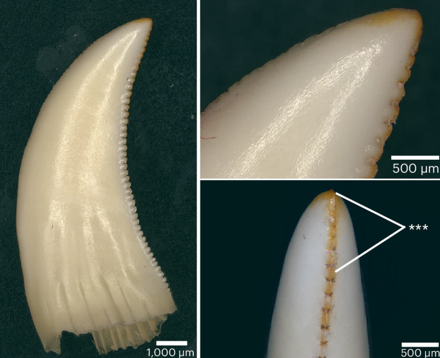 코모도왕도마뱀의 이빨. 사진=LeBlanc et al., doi: 10.1038/s41559-024-02477-7