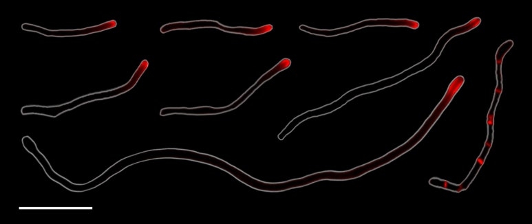 한 방향으로 성장하며 분열하는 코리네박테리움. Credit: Chimileski, Scott et al, PNAS, 2024