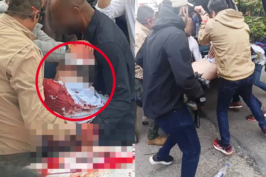 7일(현지시간) 콜롬비아 보고타에서 총격을 받은 미겔 우리베 투르바이(39) 콜롬비아 상원의원이 구급차로 옮겨지고 있다. 엑스 캡처 thumbnail - 7일(현지시간) 콜롬비아 보고타에서 총격을 받은 미겔 우리베 투르바이(39) 콜롬비아 상원의원이 구급차로 옮겨지고 있다. 엑스 캡처