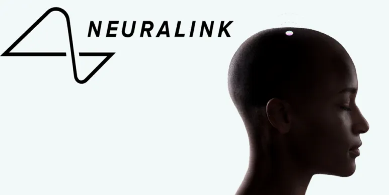 사진=뉴럴링크 thumbnail - 사진=뉴럴링크