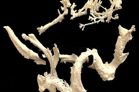 3D 프린터로 다시 복원한 스코티의 갈비뼈 내 혈관. Credit: Jerit Mitchell thumbnail - 3D 프린터로 다시 복원한 스코티의 갈비뼈 내 혈관. Credit: Jerit Mitchell