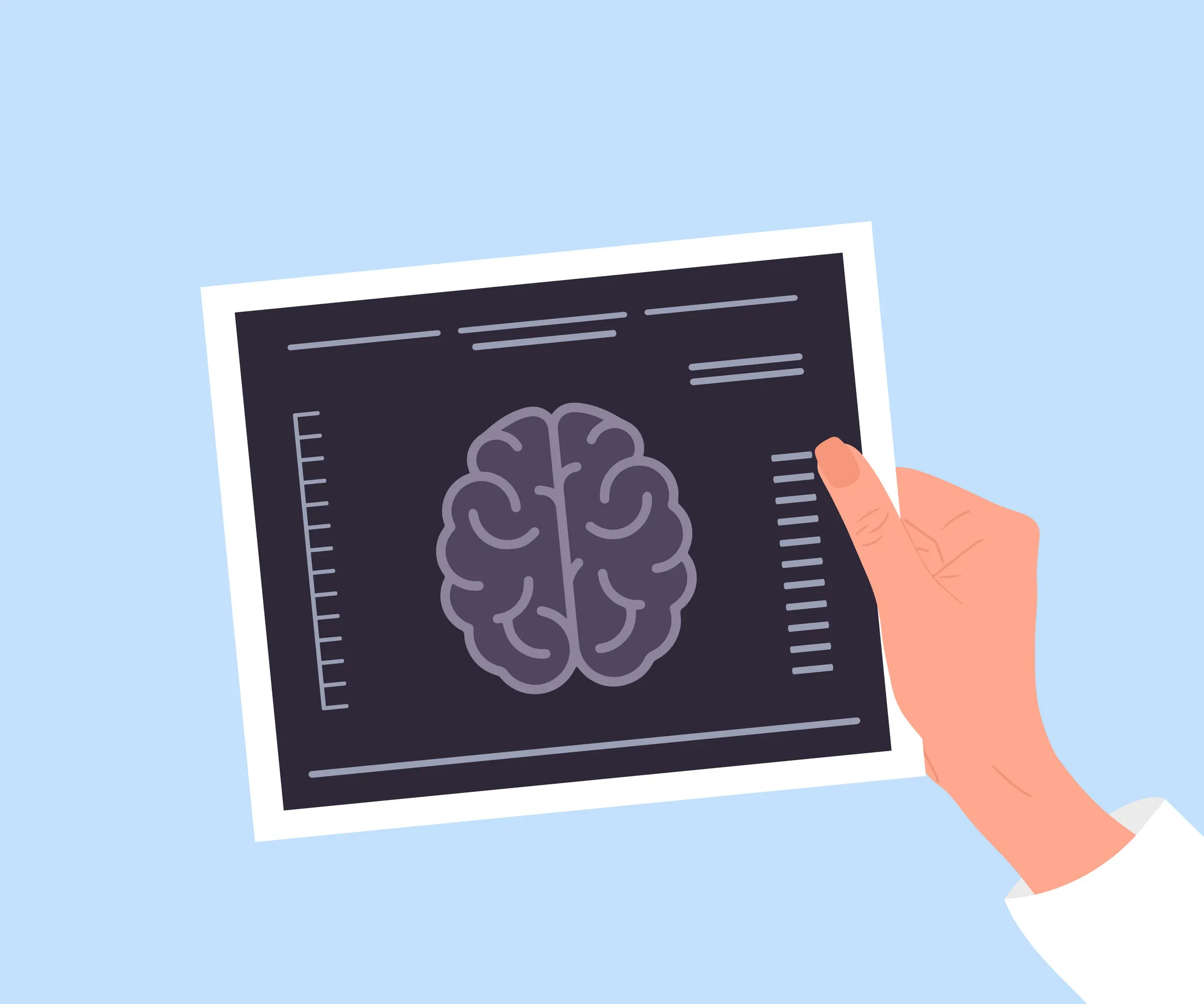 thumbnail - 뇌 영상 검사(MRI)를 형상화한 일러스트. 신체 활동은 뇌 혈류와 구조에 영향을 미쳐 치매 위험을 낮출 수 있는 요인으로 분석됐다. 123rf