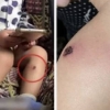 thumbnail - 이스라엘군, 18개월 아기에 담뱃불 고문…끔찍한 실체 공개