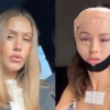 thumbnail - 한국서 성형한 33세 여성…아이폰도 얼굴 못 알아봤다