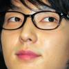 [NOW포토] 이준기 “손가락 부상당했어요”