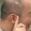 이진우 뇌출혈수술 공개… “퇴원하자마자 촬영”
