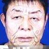 60세 얼굴가진 20대 男 ‘비포&애프터’ 화제