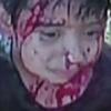 “동생 구하려고” 개와 혈투벌인 6살 소년