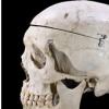 美연구팀 “인간의 두개골, 점점 더 커지고 있다”