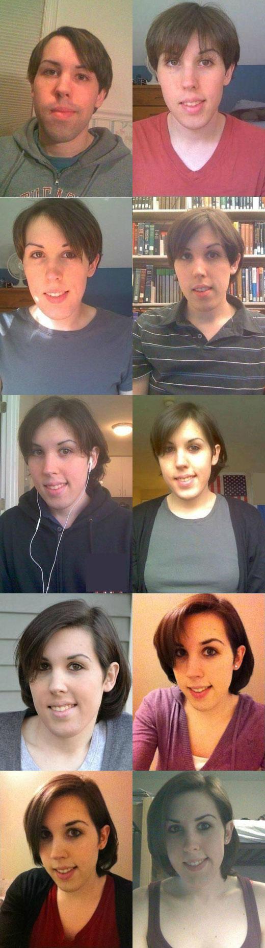 호르몬으로 여성 외모로 변모한 남성