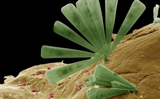 호주 서호주대학(UWA) 팀이 공개한 규조류(녹색)와 박테리아(핑크)