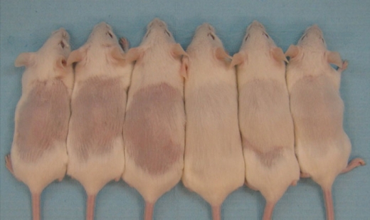 대머리, 백혈구 세포로 치료한다