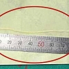 [와우! 중국] 뇌에서 8cm 기생충이…원인은 ‘개구리 고기’