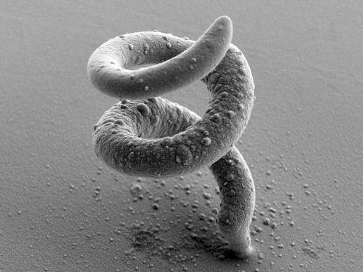 폭 15~35㎛의 초미세 금속 3D 프린터 출력물. (사진=취리히연방공과대학/ Luca Hirt)