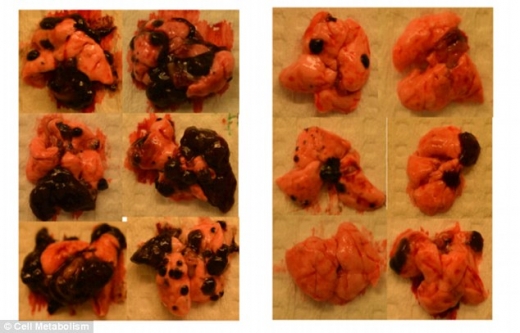 아드레날린의 영향으로 줄어든 암세포(사진=셀 메타볼리즘)