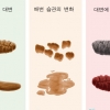 당신 대변이 당신에게 말하는 ‘건강 시그널’