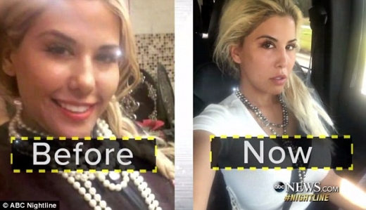 이방카 모방 성형수술을 받은 美여성 테일러