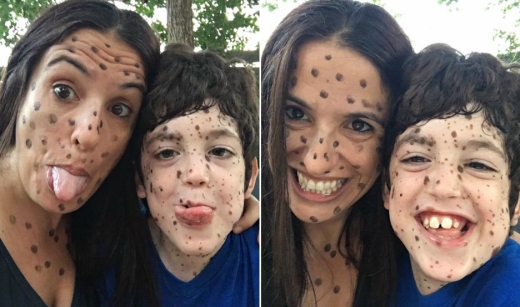 루시 자신도 얼굴에 많은 점을 그리고 나서 에레즈와 함께 사진을 찍었다.