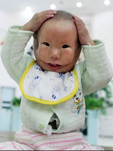 2010년 2번의 수술을 받고 한층 밝아진 모습이다. (사진=씨에프피 캡쳐)