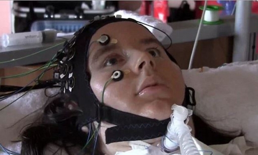 루게릭병을 겪는 실험 참가자들은 삶에 대한 긍정적인 의지를 보였다.