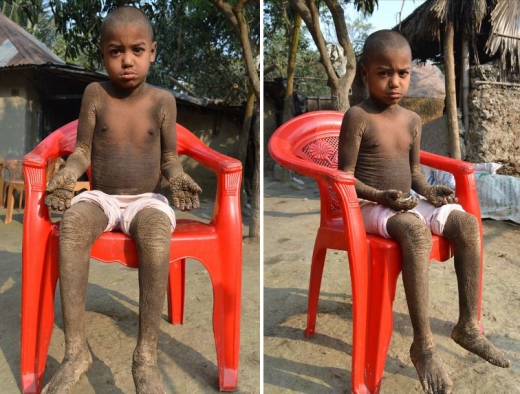 마을 사람들과 학교로부터 버림받은 그는 치료제도 없이 집에서 홀로 지낸다.