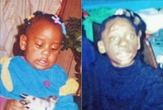 왼쪽 사진은 알리샤가 화상을 입기전의 모습, 오른쪽 사진은 화상을 입은 후의 모습이다.