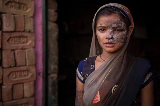 아빠는 이전에도 자신을 신고한 딸을 찾아와 선처를 구하기도 했다고 한다.