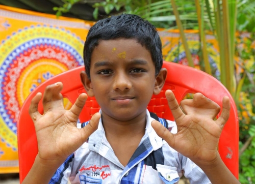 7살 애드베이스도 같은 질환을 갖고 태어났다. (사진=더썬)