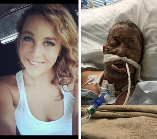 끔찍한 사고를 당하기 전 코트니는 아름다운 미모를 간직한 젊은 여성이었다. (사진=미러) 