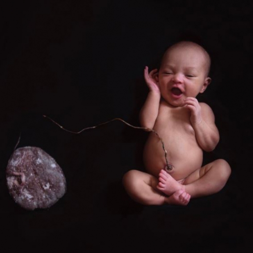 의사들은 산모가 탯줄을 자르지 않으면 그로 인해 발생할 수 있는 감염의 위험성을 지속적으로 관찰해야 한다고 말한다. (사진=데일리메일 캡쳐)