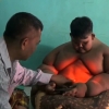 190kg 인도네시아 10세 소년, 세 달 감량…성과는?