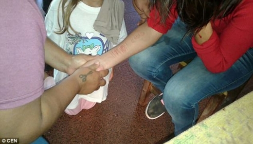 투신 자살하려던 아르헨티나 20대 여성의 팔에서 발견된 자해 흔적