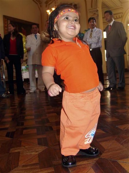 수술 뒤 활짝 웃으며 혼자 서있는 세론. 이제는 걷고 춤출 수도 있다. (사진=페루21)