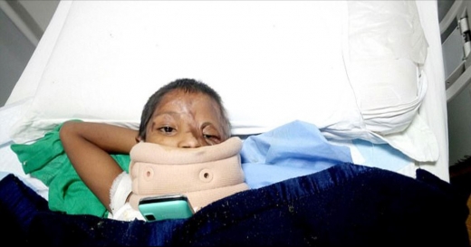 ‘차오 재단’(Chhanv Foudation)의 알로크 싱과 그의 팀에게 첫 수술을 받은 후 줄리의 모습. (사진=데일리메일 캡쳐)