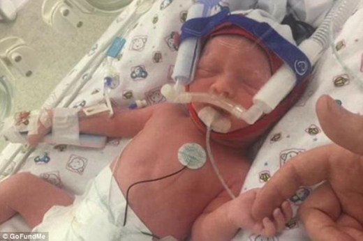 예정일보다 일찍 태어난 딸 엘리너의 모습.