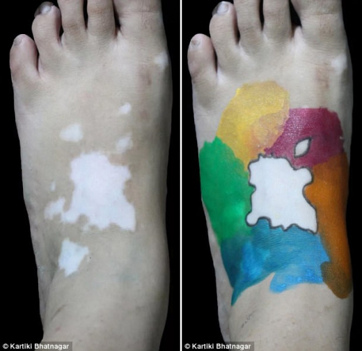 카트리키는 자신의 백색 반점이’애플사의 로고’와 닮았다는 친구의 말을 듣고 좀 더 비슷해 보이기 위해 색깔을 입혔다.