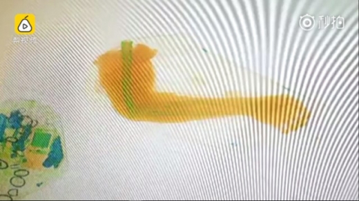 터미널 검색대 화면에 포착된 가방 속 팔의 모습.