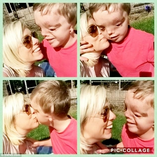 해리는 안와(눈구멍)를 만들기 위해 수차례 수술을 받았고 현재 인공귀도 착용하고 있다.