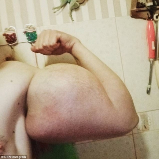 바벨 전문가는 신톨에 중독된 테레신에게 혈액 해독과 정신과 상담이 필요하다고 전했다.