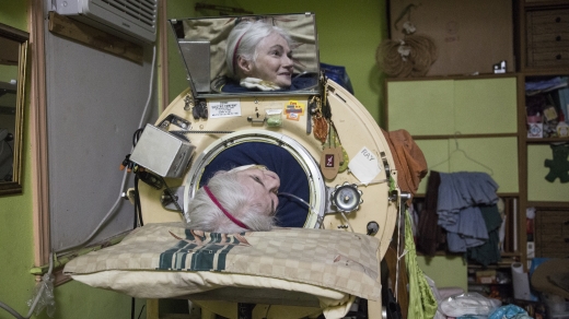 현재까지 아이언 렁을 사용하는 또 다른 환자