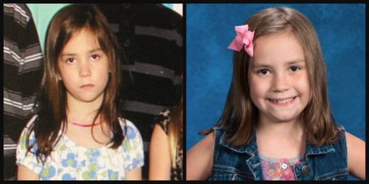 디즈니 월드에 다녀오기 전후의 큰딸 브레오나의 모습.