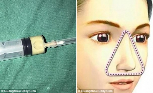 8mm의 고름과 종기, 두개골의 일부를 떼어내는 수술을 시행했다.