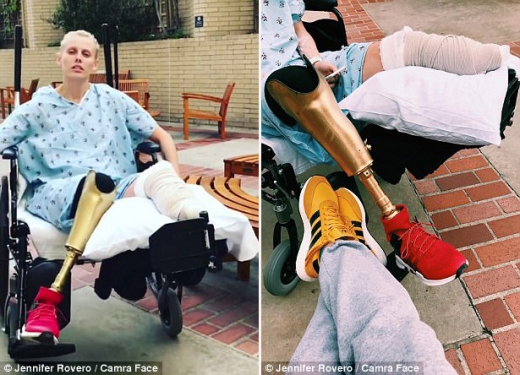 독소 충격 증후군은 바서의 모델 활동에 전혀 방해가 되지 않았다. 바서는 미 고급 백화점 노드스트롬과 미 유명 브랜드 케네스 콜의 캠페인 모델로 선정됐다.  